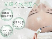 ルコル(LUCOL)