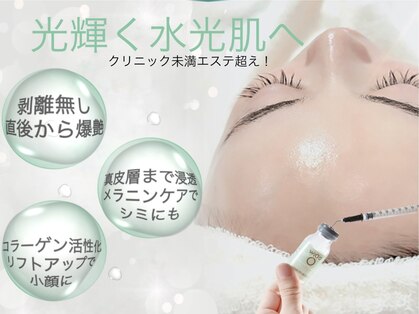 ルコル(LUCOL)の写真
