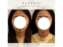 ヴィオン整体院(VION.整体院)の雰囲気（小顔矯正でフェイスラインすっきり【小顔/整体/肩こり/産後】）
