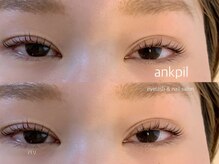 アノカプイル(ankpil)/【パリジェンヌラッシュリフト】