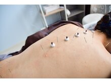 ここのはりきゅう治療院/鍼灸施術