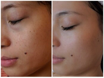 ザ シー タイムレスビューティ(THE SHE)/20代お客様症例写真