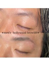 レクラ(L'eclat)/men's Hollywood browlift