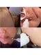 バベルトータルビューティー 北堀江店(Babel Total Beauty)の写真/毛穴洗浄/プラズマ/EMS/ラジオ波から2つ選べて新規特別価格¥1500♪ララピール化粧品使用/ナノスプレー付き
