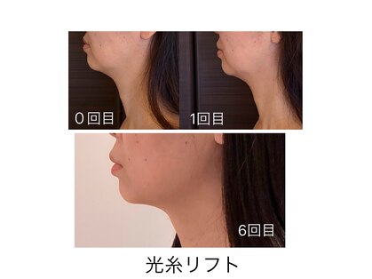 アトリエドゥアージュ(Atelier de age)の写真