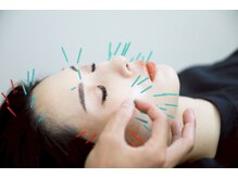 リノ ショウナン(LINO SHONAN)/美容鍼