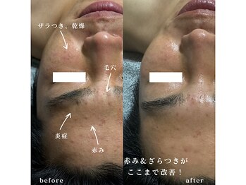 エルム 京都駅前店(elm)/＊プラズマニア＊