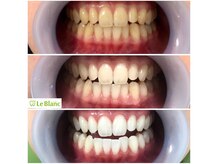 ルブラン 奈良店(Le Blanc)/回数を重ねて白くなり