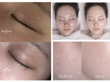 キララ(Kirara)の雰囲気(くすみ・乾燥・毛穴・ごわつき・ざらつきが気になる肌を整える☆)