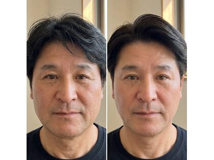 つるみ 小顔矯正 専門店の写真