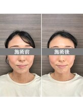 シェア 人形町店(Chare)/【小顔・骨盤矯正・О脚・整体】