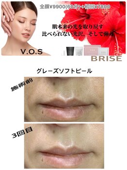 ブライズ(BRISE)/宇都宮初☆グレーズソフトピール