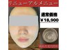 人気No.2【顔全体】毛穴ケア決定版！吸引+超音波ピーリングで毛穴掃除★100分