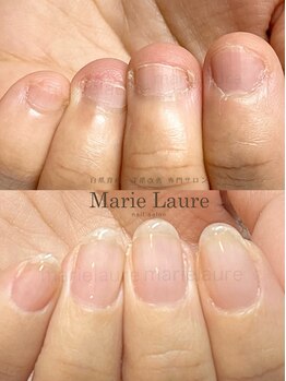 マリーロール 梅田店(Marie Laure)/深爪矯正/自爪育成/自爪風