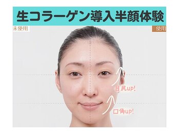 ナナ 銀座(Nana)/生コラーゲン導入違いが一目瞭然