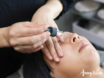 アングレイス(Anngrace)/【本気の肌質改善】奇跡のセラム