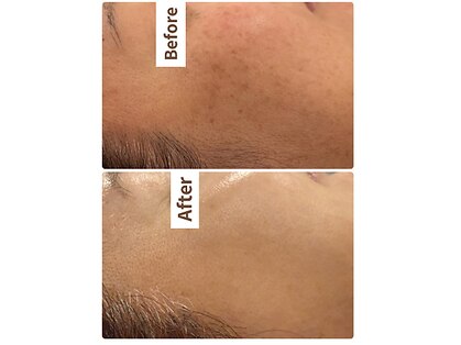 ミラ(Mila)の写真