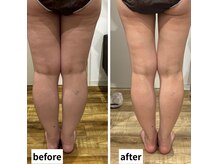 何をしても細くならなかった下半身痩せに成功！！