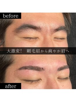 ユー 西船橋店(you)/ビフォーアフターお写真