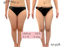 ルッカ(RUKKA)/脂肪分解ケア