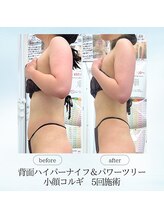 エスプレッソ(espresso,)/【痩身+コルギ】華奢な二の腕に!