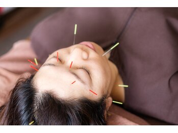 ゆうレディース鍼灸整骨院の写真/【施術歴20年以上の実績】遠方から来られるお客様も!プライベート空間で美しさと健康をトータルサポート◎