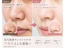 ルナ クレッシェンテ(Luna crescente)/地域でも指折りの毛穴洗浄サロン