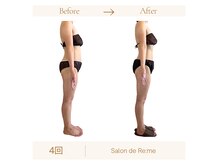 サロンドリミー 高松 国分寺(Salon de Re:me)の雰囲気(気持ちよく寝てるだけで痩せる四国初の別人級オールハンド技術)