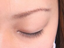 ヴィヴァーチェ 新宿店(Vivace)/施術前【２】