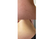 イチハチドット(18.)/最高級な草で☆