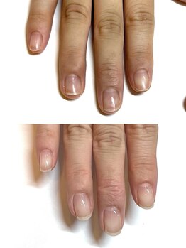 マリーロール 梅田店(Marie Laure)/自爪育成/深爪矯正/ネイルケア