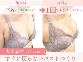 ベルフルール/バストアップ/熊本/南熊本