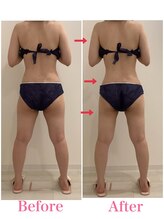 スペチアーレ 夙川/痩せにくい所に効果的