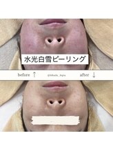 レピア(Le'pia)/水光白雪ピーリング