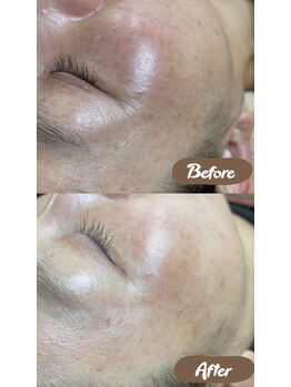 ラブニール 横浜店/スーパーフードワックス