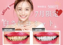 エクシアホワイトニング エミフルMASAKI店