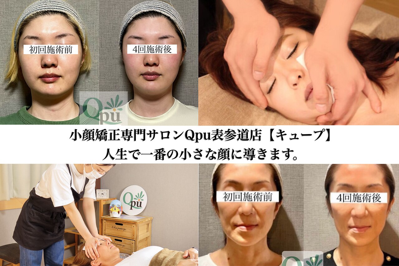 骨筋小顔トリートメント /輪郭小顔マッサージ/美容鍼/GP小顔整体　４コセット 骨筋小顔トリートメント /輪郭小顔マッサージ/美容鍼/GP小顔整体 4