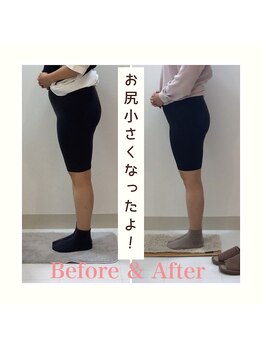 スタイルラボ高松/産後の骨盤矯正の効果♪