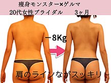 ファニービー 高槻店/症例写真