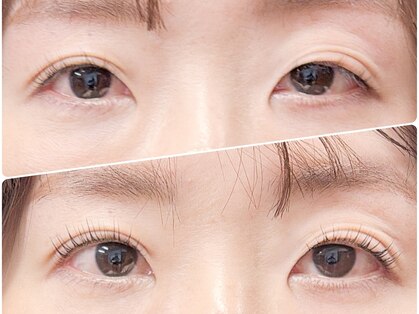 リュース(LYS)の写真
