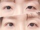 リュース(LYS)の写真