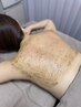 最高峰ハーブピーリングで見せたくなる背中or二の腕　ニキビ，黒ずみ，赤ポツ