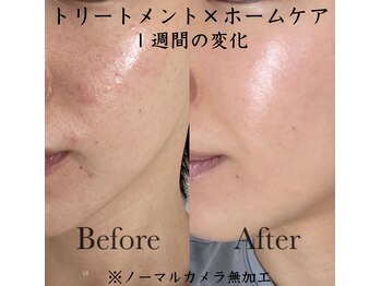 リンク(Link)の写真/<衝撃の変化>原因不明の肌悩みから解放！専門家が厳選した美容化粧品で理想のツヤ美白肌へ導く◎