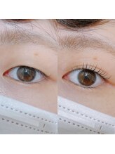 アディクト 恵比寿店(ADDICT)/一重まぶたさんの仕上がり