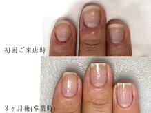 エイム(Aim)の雰囲気（ジェルNGだって3ヶ月あれば別人級に！皮膚も変わるケア育成☆☆）