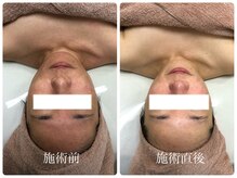 シェミー(CHEZ MEE)/【美肌】血の流れはとても大切♪