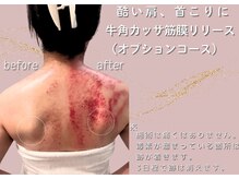 アメリオレ 三鷹店(AMELIORER)/隠れメニュー牛角カッサ