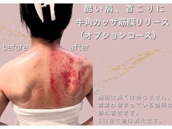 アメリオレ 三鷹店(AMELIORER)/隠れメニュー牛角カッサ