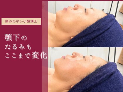 ジョンミー(JONMEE)の写真