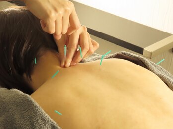 和らの写真/【施術実績7500名以上！国家資格保有の女性スタッフ　初めてで不安な方も痛みは少ないのでお任せを！】